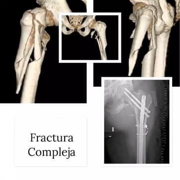 Slider image (2) Dr. Rodrigo Aguirre Rojas Orthopedic Surgeon in Mexico